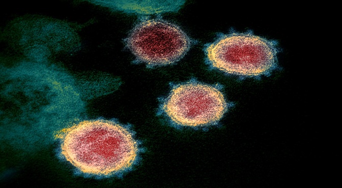 Una muestra de coronavirus recogida de uno de los primeros casos en Estados Unidos.
